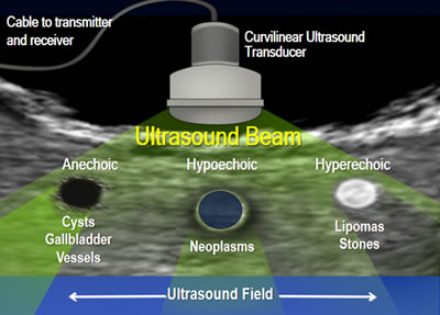 Ultrasound beam